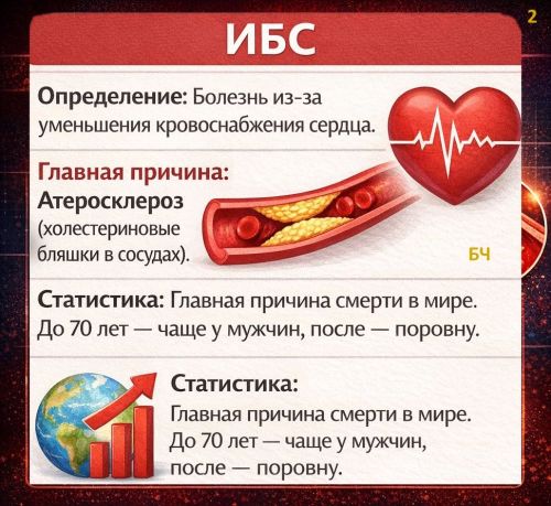 Что такое ишемическая болезнь сердца? (карточки)