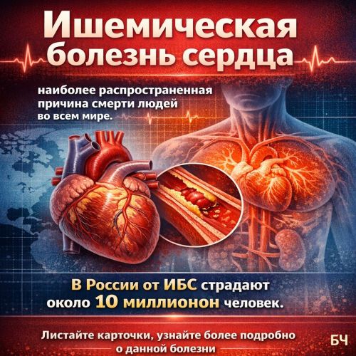 Что такое ишемическая болезнь сердца? (карточки)