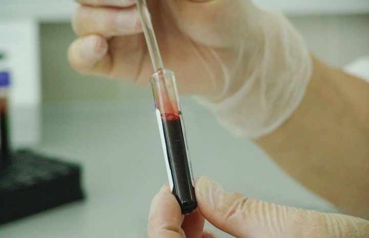Чирмешән районында ВИЧ-инфекцияле 30 кеше яши